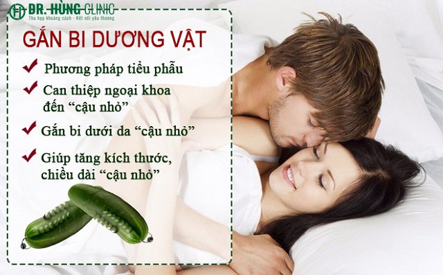 Gắn bi dương vật