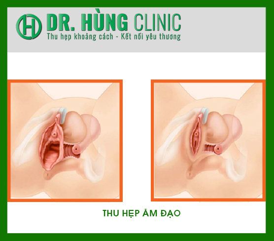 phong-kham-dr-hung-clinic-la-dia-chi-uy-tin-trong-linh-vuc-tham-my-vung-kin