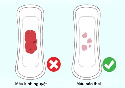 Kinh nguyệt không đều làm sao biết có thai?