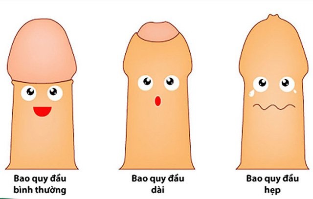 bao-quy-dau-bi-dai-hoac-hep-lam-tich-tu-chat-ban-gay-benh