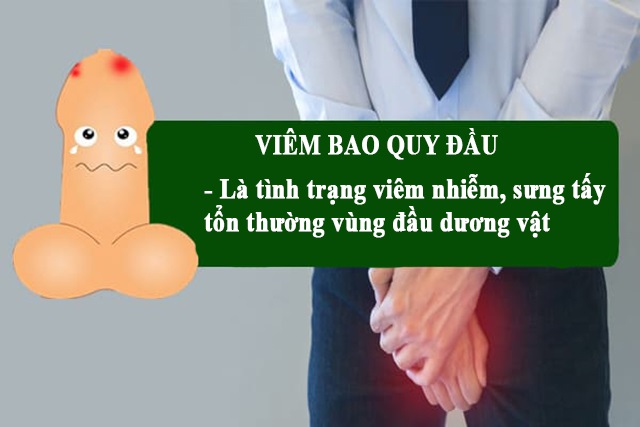 viem-bao-quy-dau-la-benh-gi