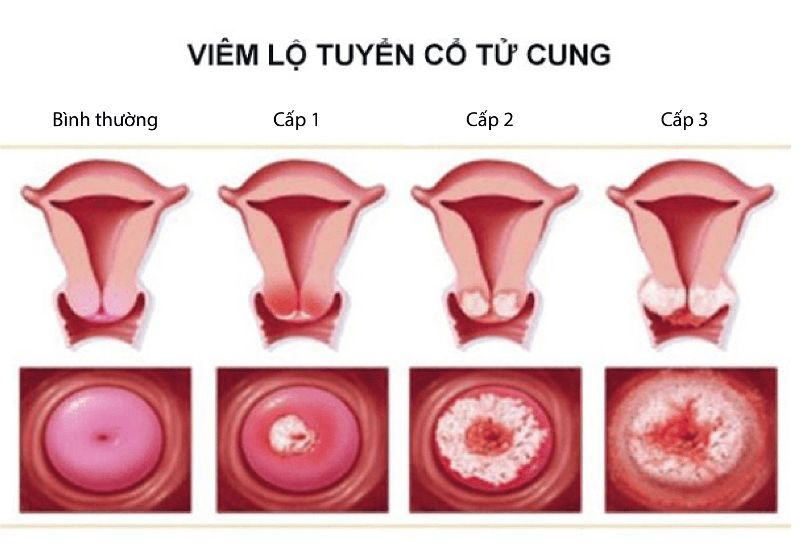 the-nao-la-tu-cung-binh-thuong-va-khong-binh-thuong